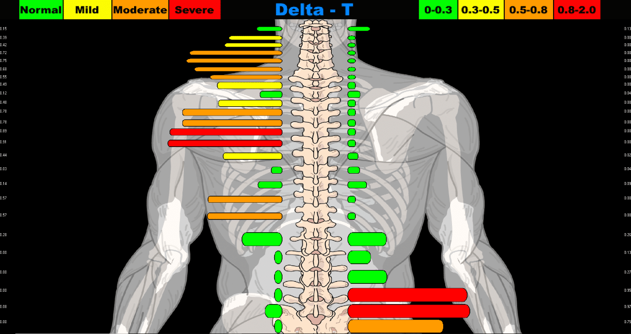 Our Approach - Chiropractor Pensacola FL - Dynamic Life Chiropractic